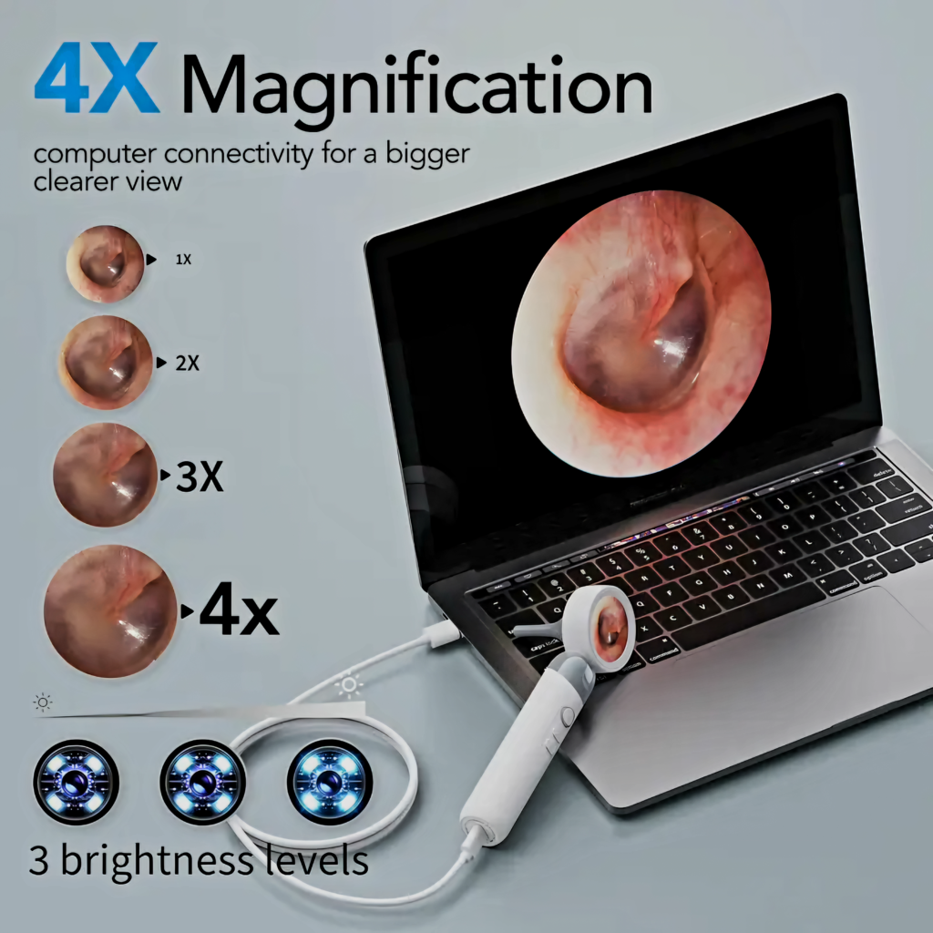 Demonstration of the 4X magnification feature with the device connected to a laptop for a larger and clearer view on the screen.